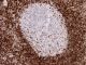Anti-Bcl2 mouse monoclonal,  0,1 ml,  Species x-Reactivity:  human,  Applications: IHC