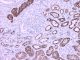 Anti-Napsin A, mouse monoclonal,  1 ml,  Species x-Reactivity:  human,  Applications: IHC