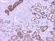 Anti-Napsin A, mouse monoclonal,  1 ml,  Species x-Reactivity:  human,  Applications: IHC