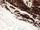 Anti-Melan A, mouse monoclonal,  1 ml,  Species x-Reactivity:  human,  Applications: IHC