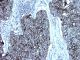 Anti-HER2, mouse monoclonal,  1 mL,  Species x-Reactivity:  human,  Applications: IHC