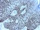 Anti-p63a mouse monoclonal,  1 mL,  Species x-Reactivity:  human,  Applications: IHC