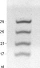 R1090,   ZR small-RNA™ Ladder  (10 ?g)